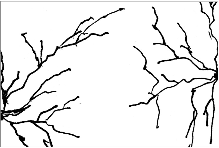 Zwei Neuronen und die Dendriten